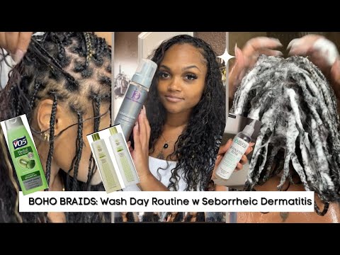 Wash Day Routine, BOHO Braids, Seborrheic Dermatitis + 🥳 300K GIVEAWAY! 🥳