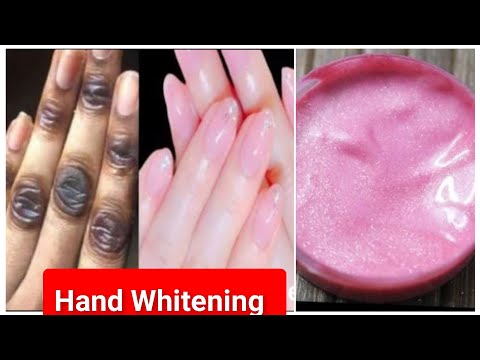 काले गंदे हाथों को गोरा गुलाबी मुलायम बनाने का चमत्कारी उपाय | Hand Whitening Home Remidies