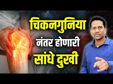 चिकनगुनिया नंतर होणारी सांधेदुखी | Chikunguniya Fever Joint Pain Ayurveda || dr nagarekar ||