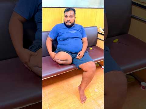 🤯Above Knee Prosthetic Leg | Ossur Pneumatic Knee Joint | Nakli Tang | Ossur Carbon Foot | #ossur