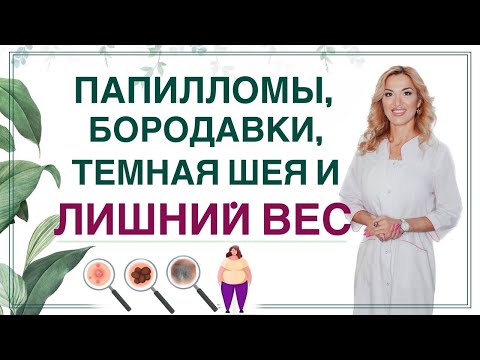 ❤️ ОЖИРЕНИЕ, ИНСУЛИН И  ПАПИЛЛОМЫ, БОРОДАВКИ, ТЕМНАЯ ШЕЯ.  Врач эндокринолог диетолог Ольга Павлова.