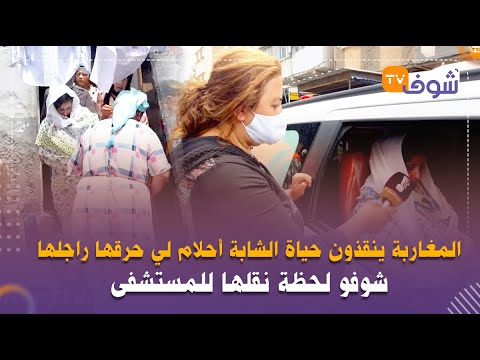 بعد فيديو شوف تيفي..المغاربة ينقذون حياة الشابة أحلام لي حرقها راجلها وتحولات لمومياء ولحمها خناز