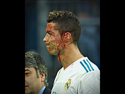 Ronaldo almost went blind😢 #ronaldo #football #cr7 #edit #cristiano #cristianoronaldo