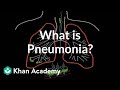 Exploring Pneumonia: Symptoms and Causes