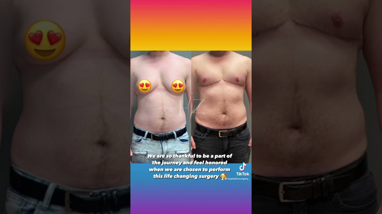 Before and after plastic surgery transformation.