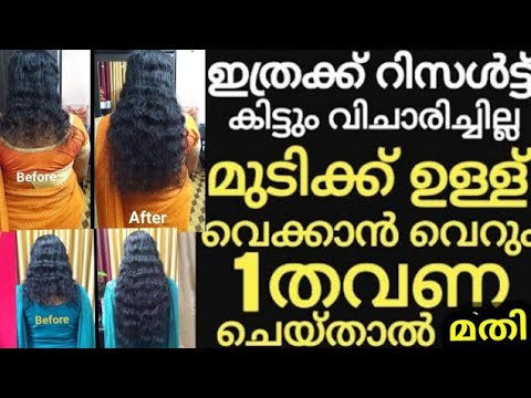ലക്ഷകണക്കിന്‌ ആളുകൾക്ക് result കിട്ടിയ3Ingredients Natural Tip മുടി പെട്ടെന്ന് വളരും