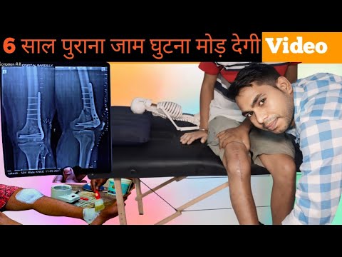 knee bending exercises after surgery in hindi, how to cure knee stiffness, jaam ghatna kaise mode