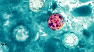 YouTube video thumbnail: How Trump Admin Cuts Have Compromised Food Safety