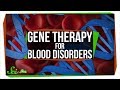 Gene Therapy and Sickle Cell Disease