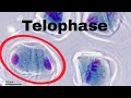 Understanding Telophase in Mitosis