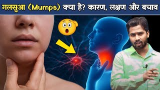 गलसुआ (Mumps) क्या है? कारण, लक्षण और बचाव.?