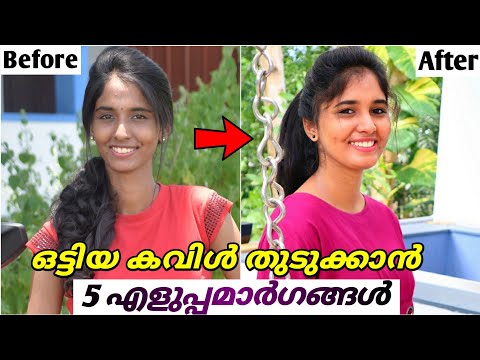 5 Easy Tips🔥 to gain fat Cheeks😄🔥Easy Remedies for get chubby Face😊✌️
