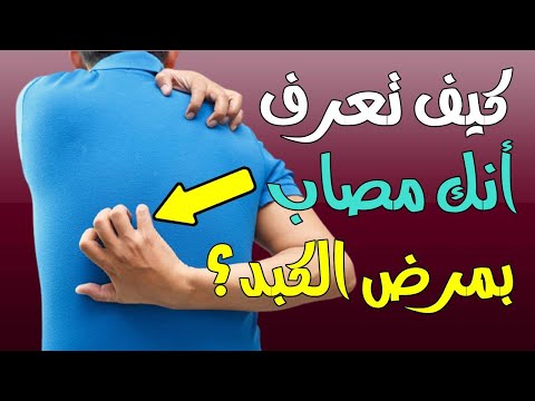 أعراض مرض الكبد - كيف تعرف أنك مصاب بمرض الكبد بعلامات تحذيرية قد لا تخطر في بال؟