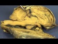 Brain Structure and Function Assessment