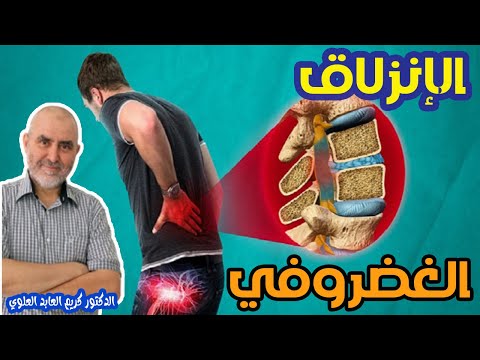 الإنزلاق الغضروفي احتكاك في فقرات الظهر   -  الدكتور كريم العابد العلوي  -