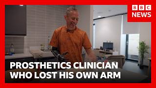 YouTube video thumbnail: ‘I Worked With Prosthetic Limbs, Then I Lost my arm’ 