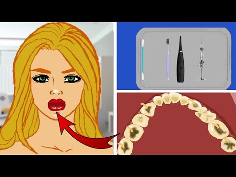 ASMR  Teeth Treatment Removal of Girl Parasite by | Teeth Deep Cleaning