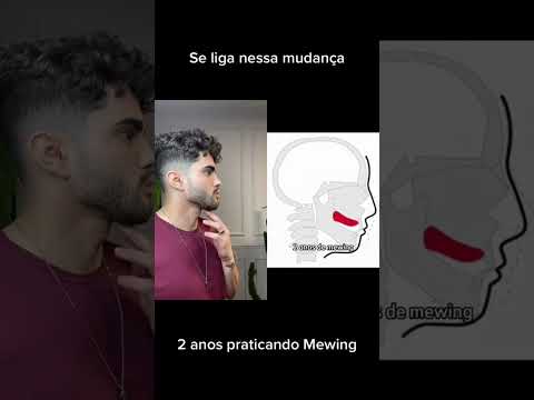 Quer saber o que é Mewing? Então se liga! Por aqui e também no meu