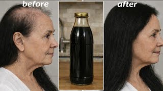 Spray it on your hair for just 2 days,🌾and your hair will grow 3 times faster /  hair growth tips