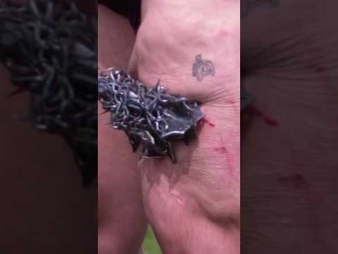 A Spike Went ALL THE WAY In My Leg 😵 #shorts #funny #comedy