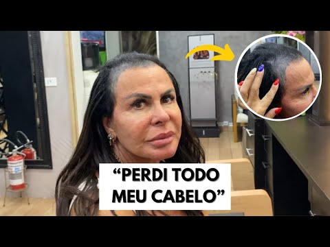 Tudo sobre a queda de cabelo da Gretchen | VEJA A TRASFORMAÇÃO! | VÍDEO COMPLETO