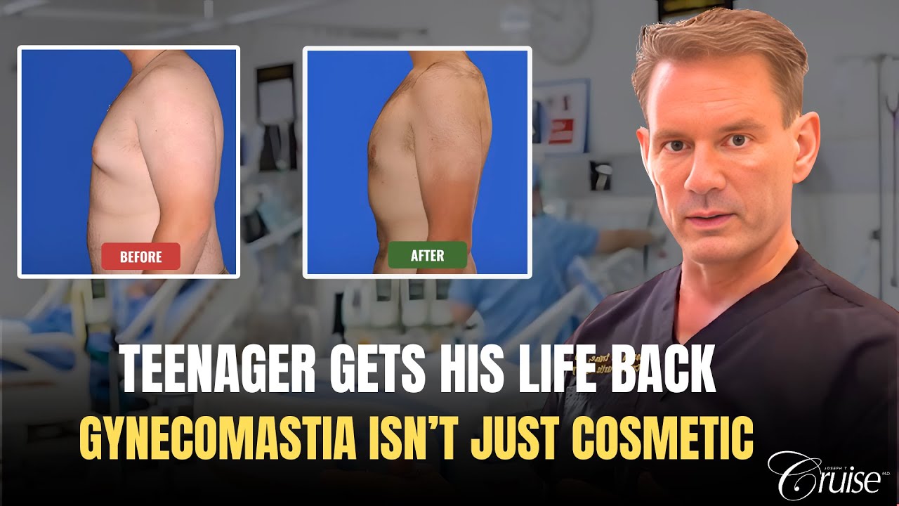 Before and after gynecomastia treatment images.