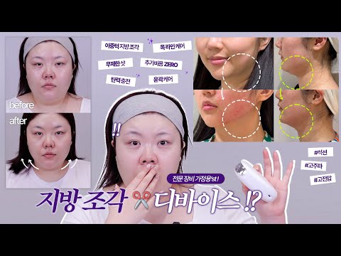 *(sub)🚨투턱 주목🚨이중턱 흡입 디바이스!? 화제의 세라매스 델 리뷰! (+라이브 마켓 공지)