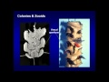 Graptolite Studies and Their Significance