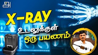 X-Ray🩻 | The Invisible Eye | Tamil | Arinthu Kolvom 