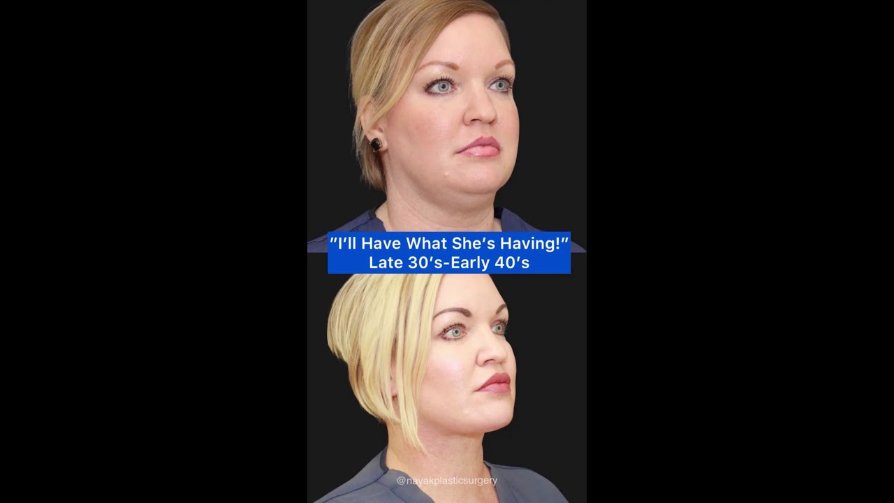 Before and after plastic surgery transformation.