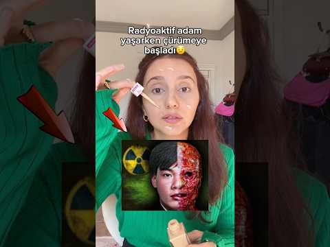 Radyoaktif adam yaşarken çürümeye başladı😪😪 #storyteller