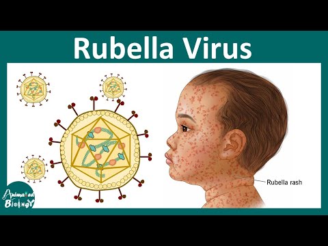 Rubella | German Measles | Rubella virus | pathogenesis, diagnosis and treatment of Rubella