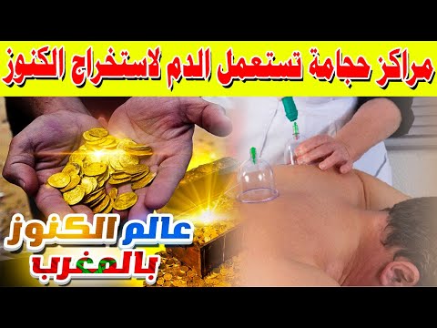 مراكز حجامة تستعمل الدم لاستخراج الكنوز