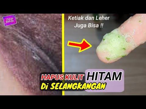 Selangkangan,Ketiak,Leher Hitam dan Gelap --》Gunakan Cara Ini