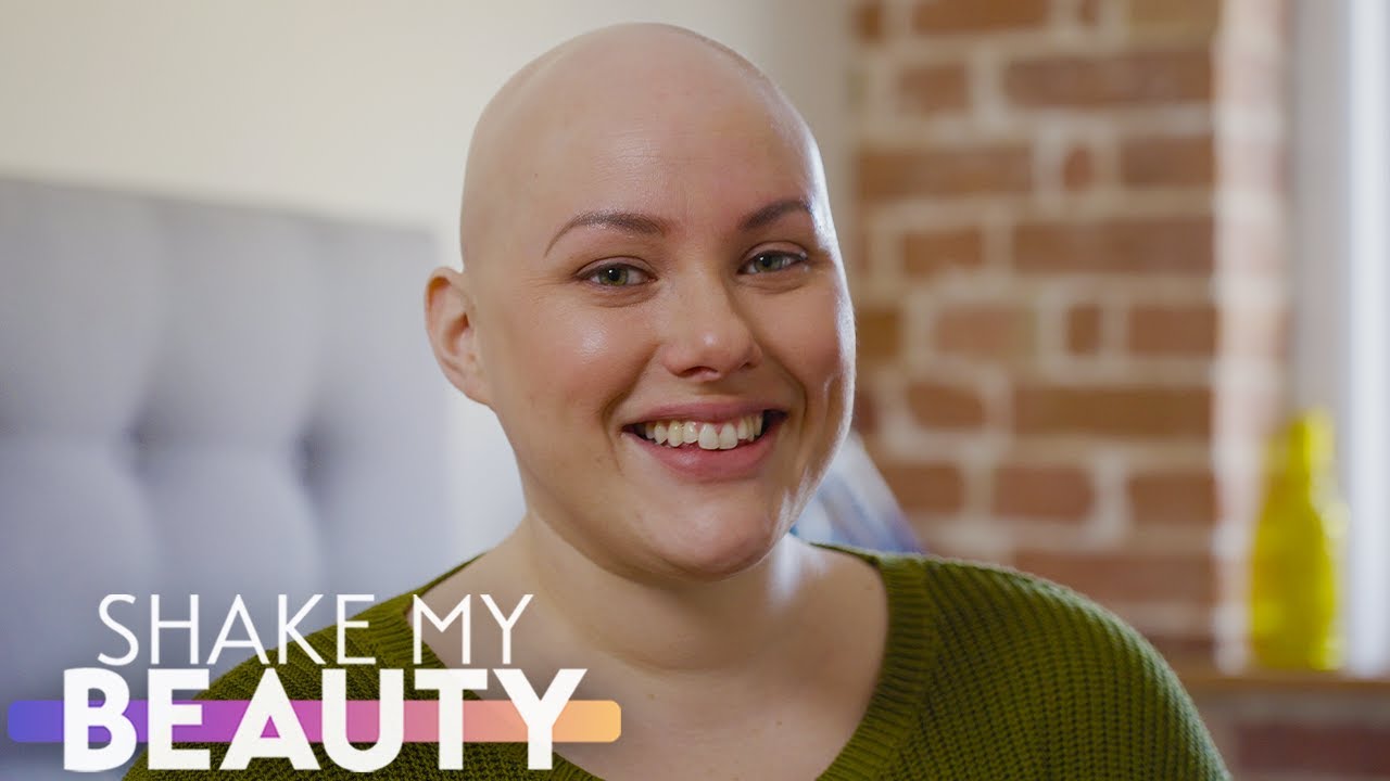 I hid my bald head for 16 years - not anymore - shake my beauty