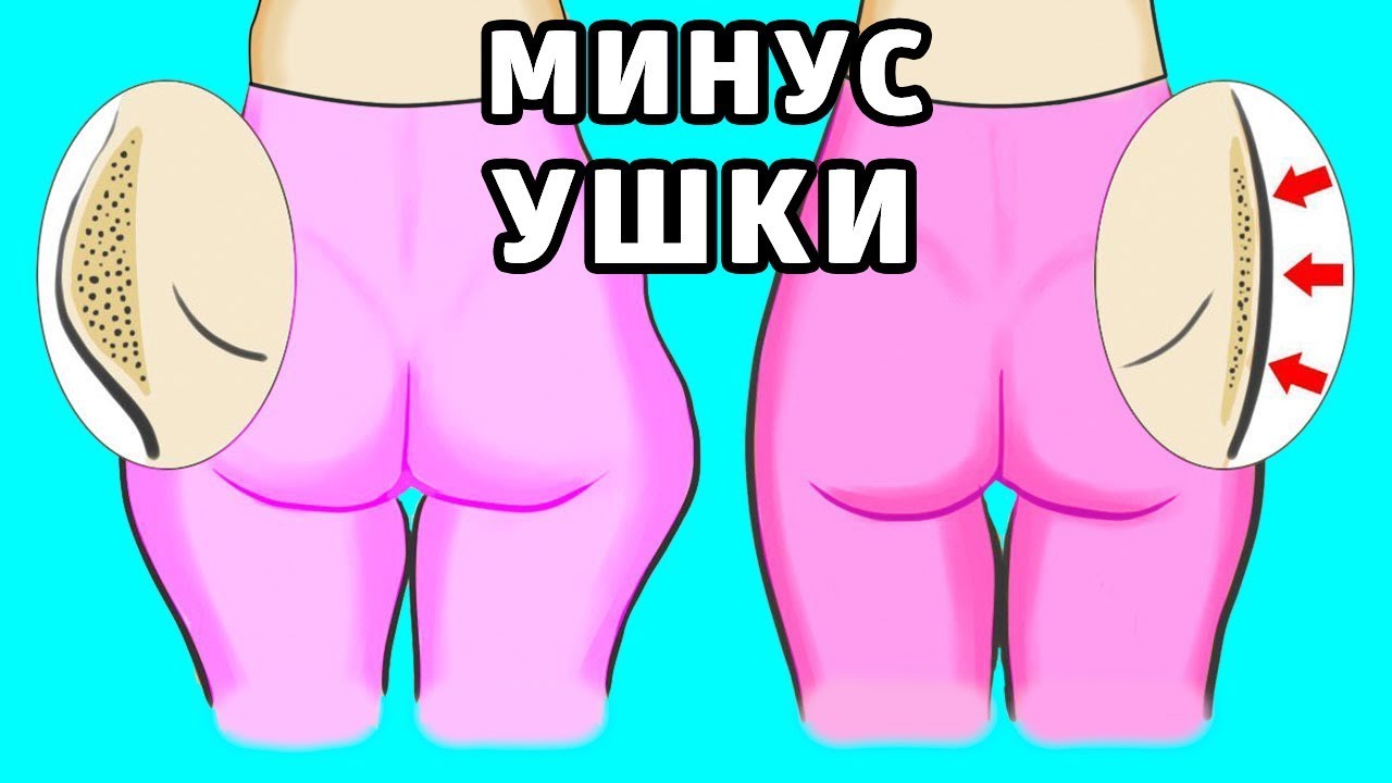 Как убрать ушки на бедрах в домашних условиях быстрый результат