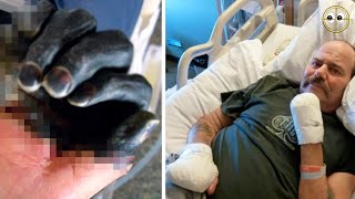Remember the MAN who INTERACTED with a MOUSE and lost his LIMBS? He started SMILE again!
