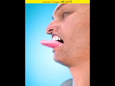 Why does the tongue bite during seizures?