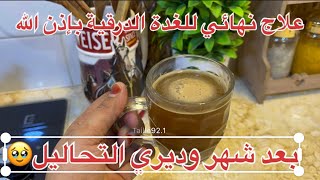 اسرع علاج للغدة الدرقية بإذن الله 🤎