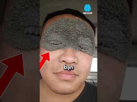 Tên thanh niên bị gì, bạn biết không?