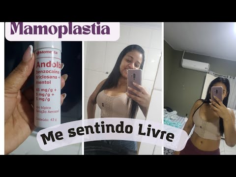 TIREI OS PONTOS / MAMOPLASTIA COM Dr. Katrienne Martinelli