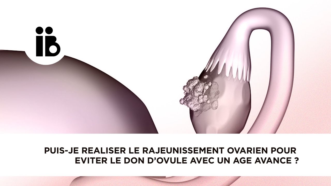 Puis-je réaliser le rajeunissement ovarien pour éviter le don d’ovule avec un âge avancé ?