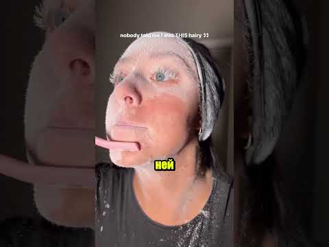 Редкая болезнь заставляет её бриться каждый день 😢🪒