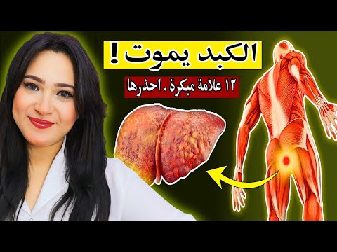 أحذر.. 12 علامة غريبة تدل على تلف وموت الكبد | أقوى طعام لعكس تلف الكبد وازالة السموم والندبات منه