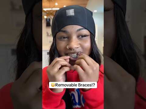 🥰Who else ❤️’s their braces this much?  #braces #retainers #orthodontics #orthodontist #bracesoff
