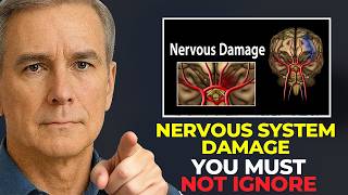 Understand Sjogren's Disease Brain and Nervous System Damage! in 3 Minutes