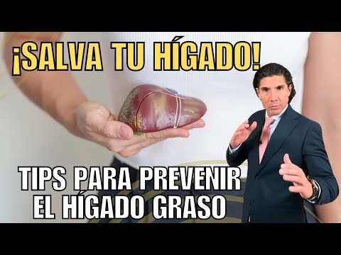 ¡Salva tu Hígado! Tips para Prevenir el Hígado Graso