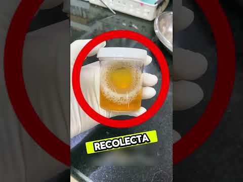 La prueba de la rana