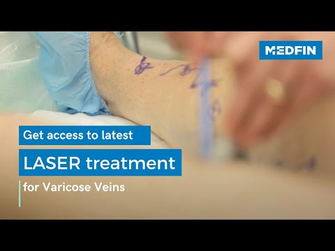 Varicose Vein LASER Treatment