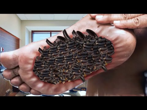 treatment ASMR sedative animation treatment of injured foot  ASMR